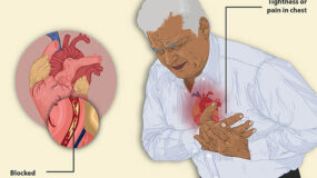 Signs of a Heart Attack and What To Do in Humble TX