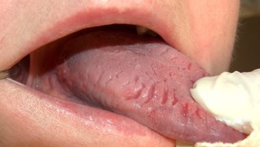 5 Warnings From Your Tongue