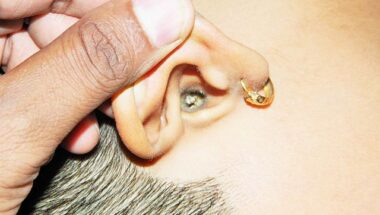 Ear Wax Removal in Atascocita TX