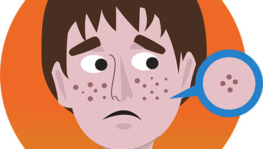 Top Dermatologists in Atascocita TX