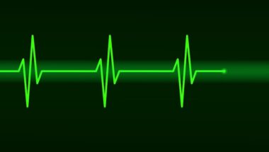 What Is An EKG